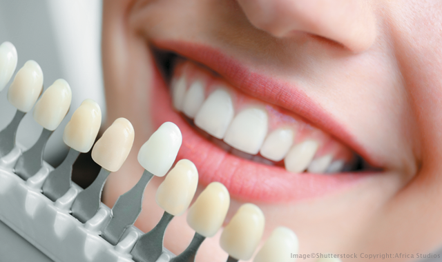 5 Benefits of Choosing the Best Cosmetic Dentist