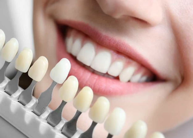 How To Find the Best Dentist in North Sydney?