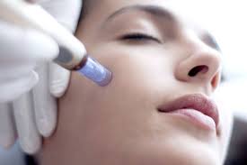 Addressing Skin Texture with Microneedling: Smoothing Uneven Areas