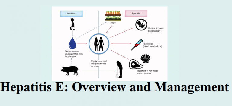 Hepatitis E: Overview and Management