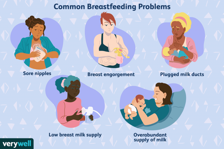 Common Breastfeeding Problems: Identifying and Solving Them