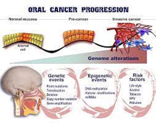 Unveiling the Complexity of Oral Cancer: Insights into Causes, Symptoms, and Treatment Trends in 2023