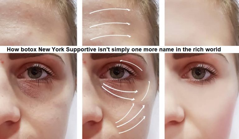 How botox New York Supportive isn’t simply one more name in the rich world