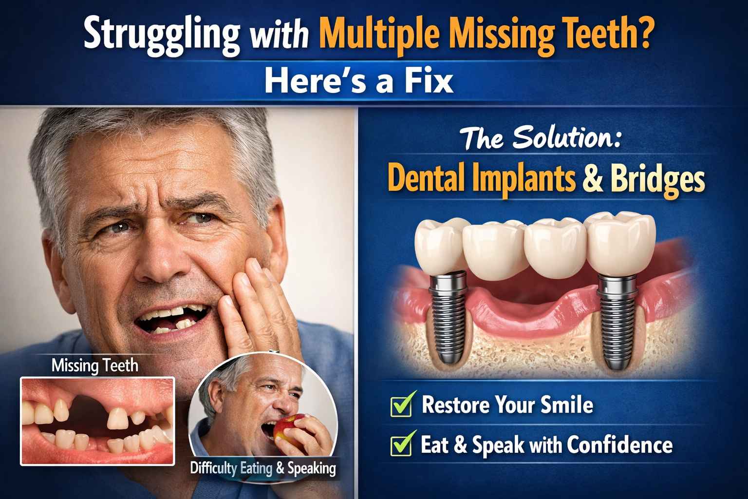 Struggling with Multiple Missing Teeth? Here’s a Fix